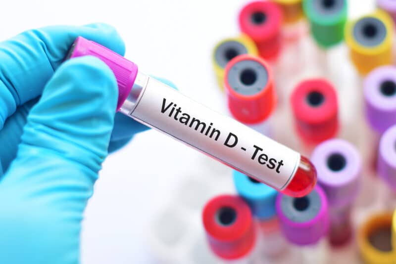 HOW MUCH VITAMIN D SHOULD I TAKE?_Vitamin D-Test